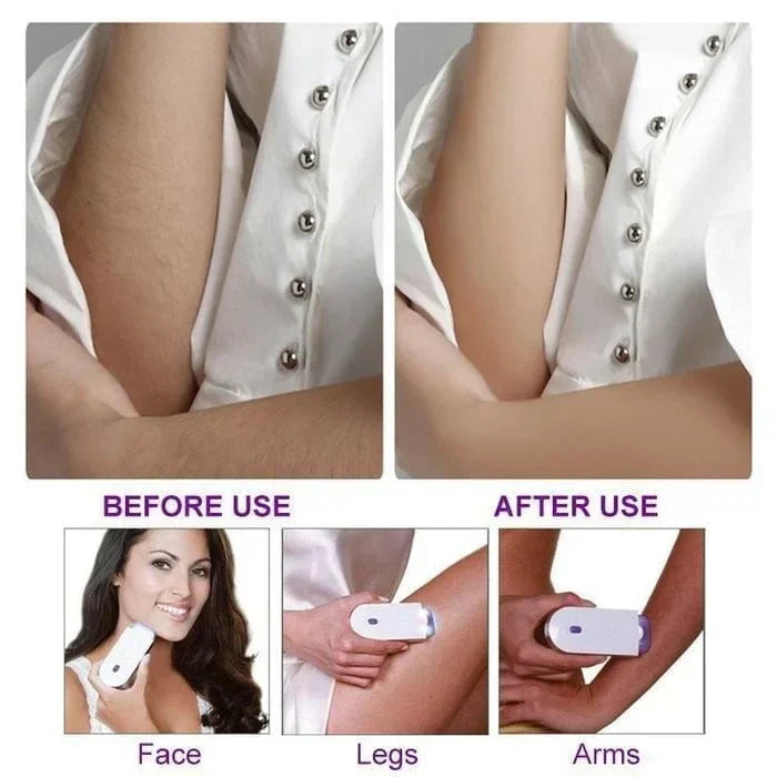 Finishing Touch Hair Epilator 🌸- Hair Remover