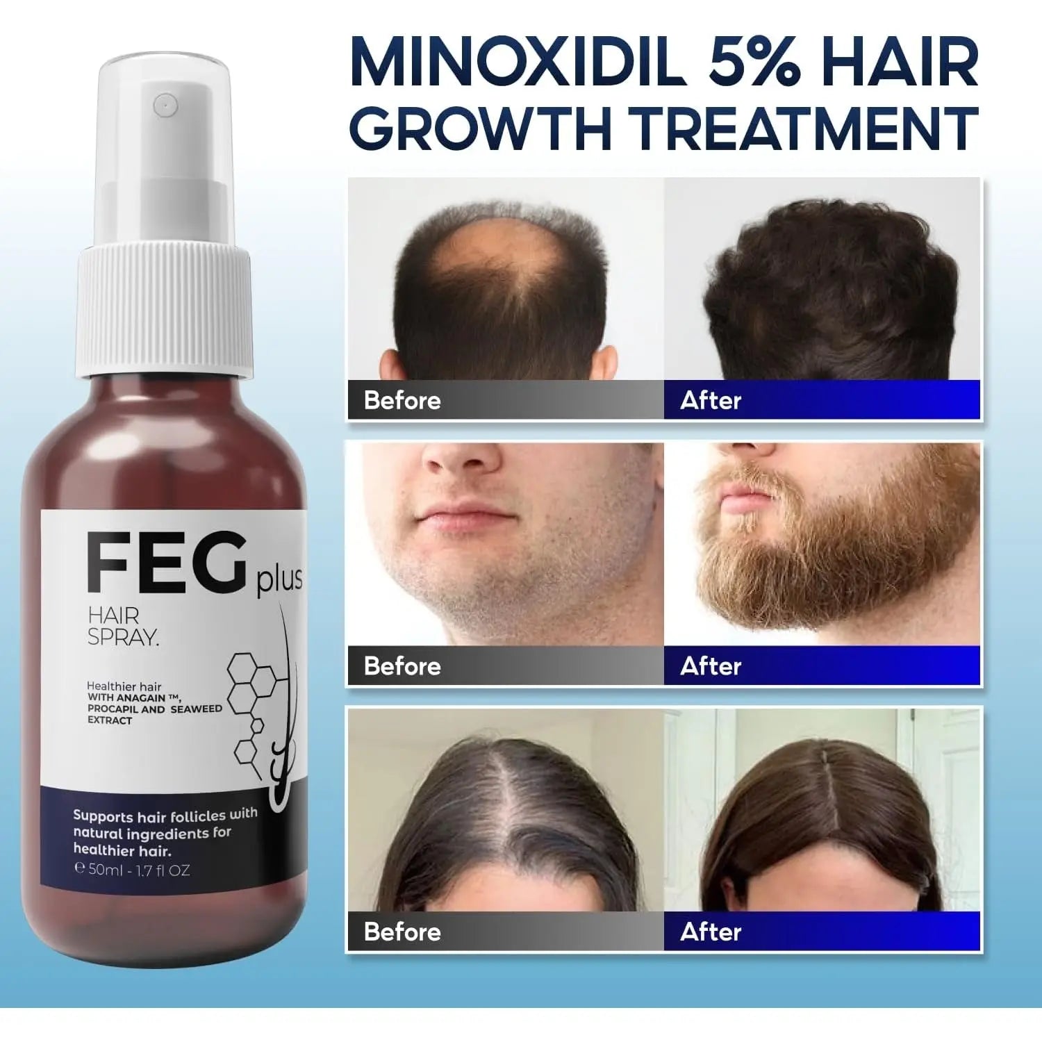 FEG Plus Hair Growth Spray